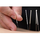 Иглы акупунктурные позолоченные стерильные Мед-Кит 0,2х30 мм с направителем 100 шт в упаковке